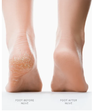 Discover the benefits of effective foot care.